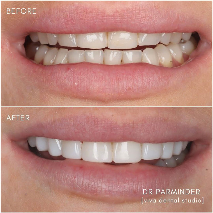 before and after