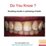 Smoking effects on teeth dentist Hornchurch Essex Viva Dental Studio